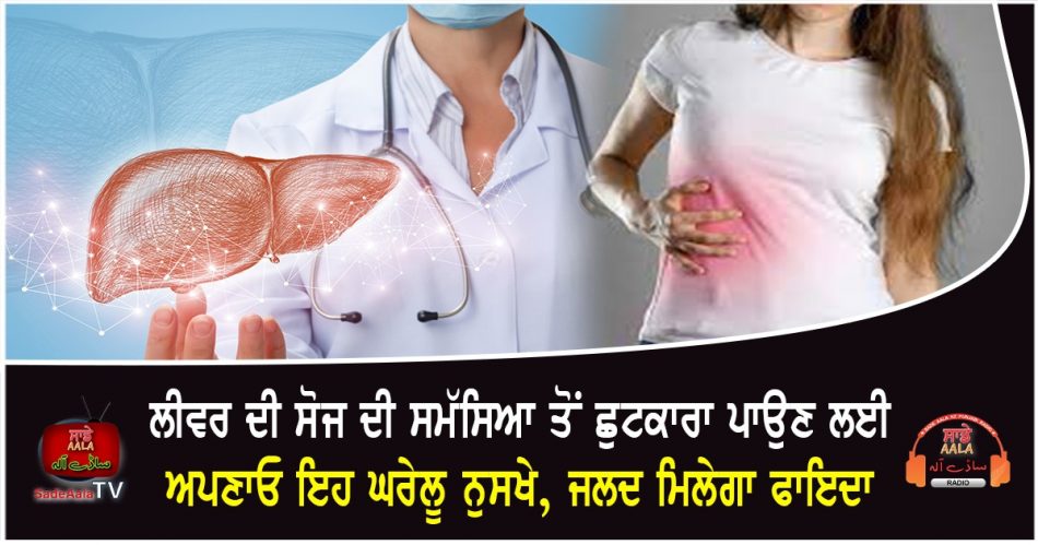 home remedies for fatty liver