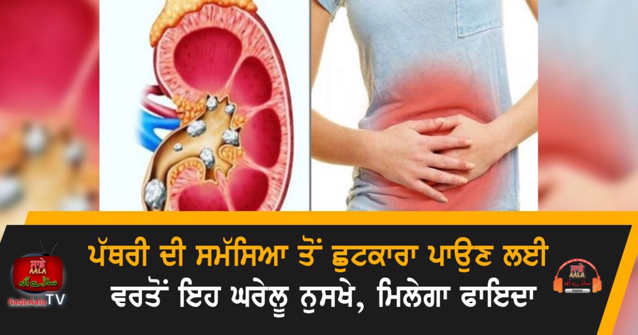 home remedies for kidney stones