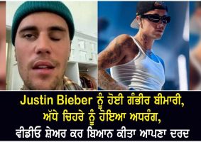 justin bieber reveals facial paralysis