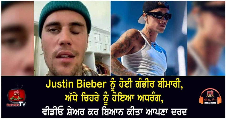 justin bieber reveals facial paralysis