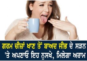 home remedies to heal a burnt tongue