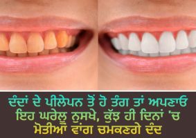 worried about yellowing of teeth