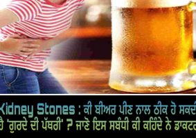 kidney stones drinking beer