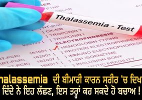 thalassemia symptoms of prevention tips