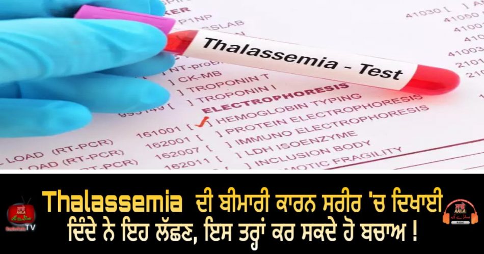 thalassemia symptoms of prevention tips