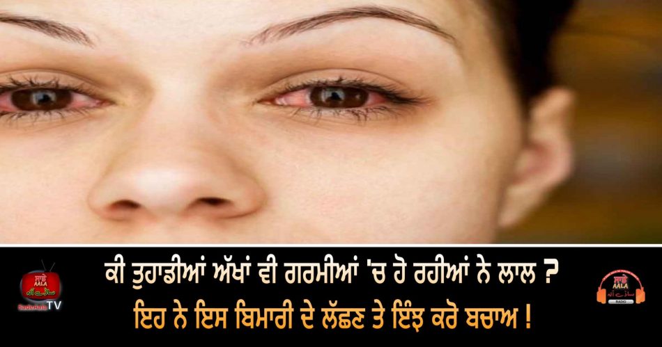 eye problems in summers