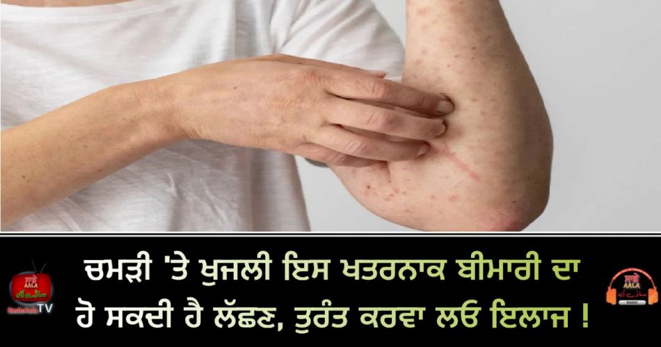 rashes on skin is a symptom