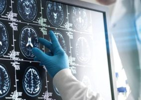 cost of medical imaging scans increases